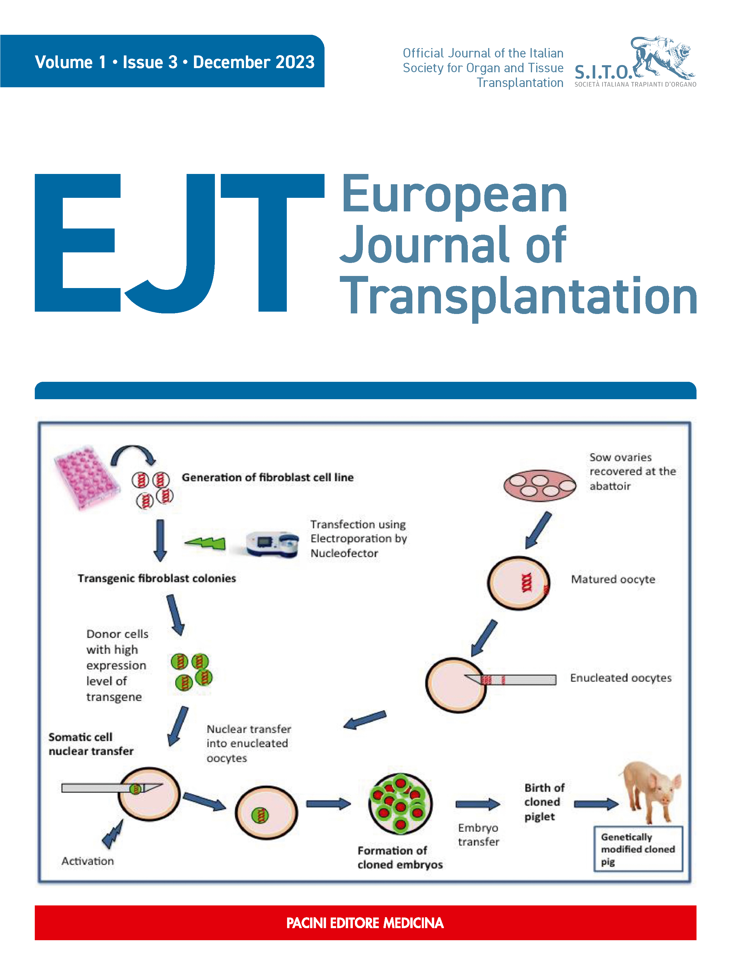 Special Issue 3 - December 2023 - Transplant Immunology